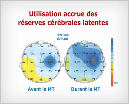 Méditation Transcendantale : utilisation accrue des réserves latentes du cerveau